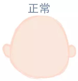 宝宝圆头好还是扁头好？这些奥秘好多爸妈都不知路5.webp.jpg